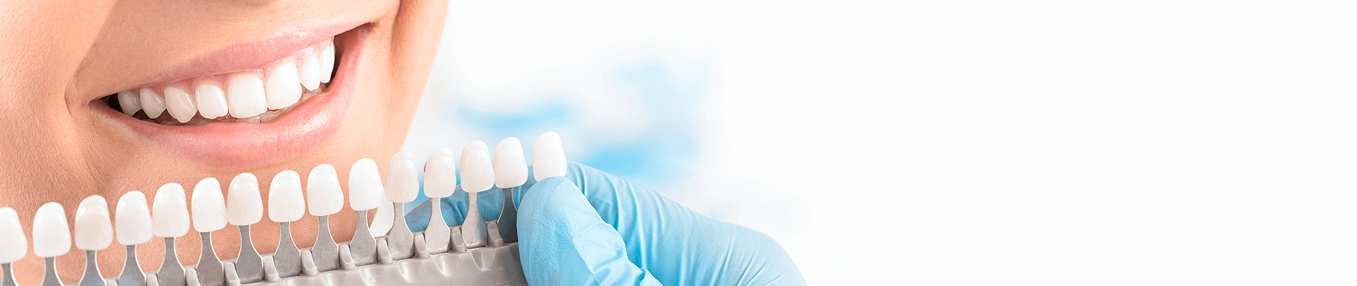 Dental Veneers in Trumbull, Connecticut